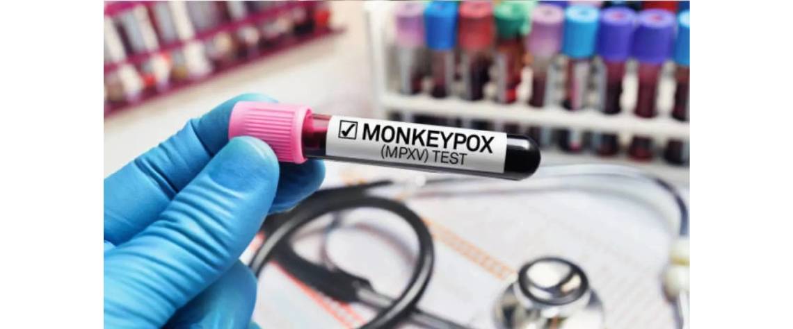 MONKEYPOX100924.jpg